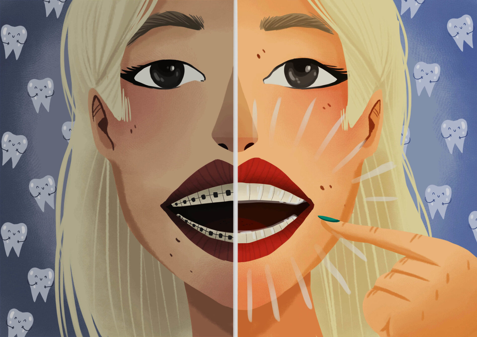 clear aligners vs. braces, Colony Dental Care, San Antonio dentist, clear aligners, traditional braces, Invisalign, orthodontic treatment, Dr. James Oei, teeth straightening options, dental care decisions